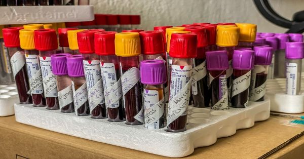 Impulsa IMSS Puebla donación de sangre en el Hospital de Chignahuapan IMSS BIENESTAR