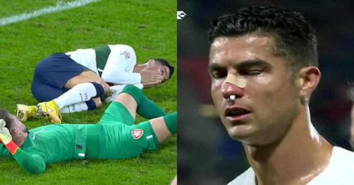 Tremendo golpe recibe Cristiano Ronaldo, termina ensangrentado