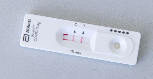 Permanecen dos casos activos por Covid-19