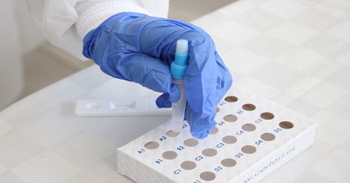 Reportan 72 nuevos contagios de SARS-CoV-2 en Puebla durante el fin de semana