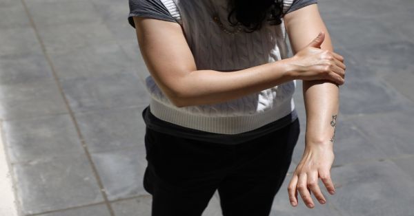 Llama IMSS a la población a prevenir cáncer de piel
