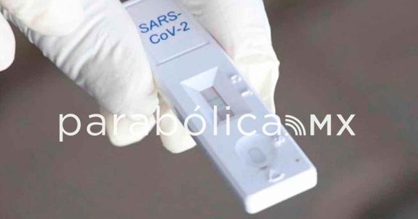 Reporta Salud un caso grave de Covid-19