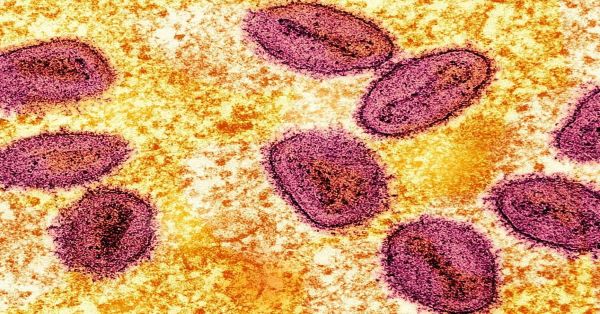 Alerta en África por más de 50 mil contagios de viruela del mono