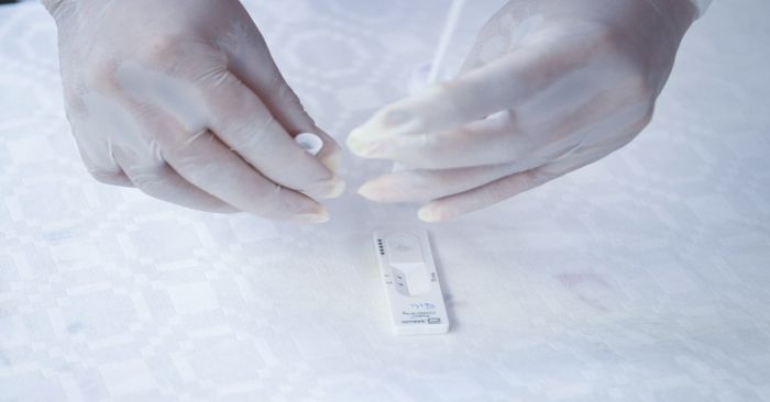 Registra Puebla el primer caso positivo de Covid-19 en el 2024