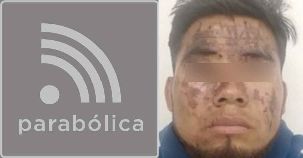 Atacó con ácido a su ex pareja y a su ex suegra; pasará 4 décadas en prisión