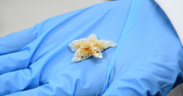Crean investigadores BUAP esponjas biodegradables para regeneraci&oacute;n &oacute;sea