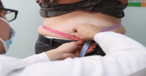Aumentan casos de obesidad en México