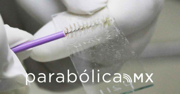 Busca IMSS prevenir el Virus del Papiloma Humano