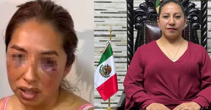 Acusan a alcaldesa de Capulhuac, Edomex de agresión sexual y física