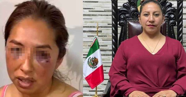 Acusan a alcaldesa de Capulhuac, Edomex de agresi&oacute;n sexual y f&iacute;sica