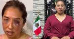 Acusan a alcaldesa de Capulhuac, Edomex de agresión sexual y física