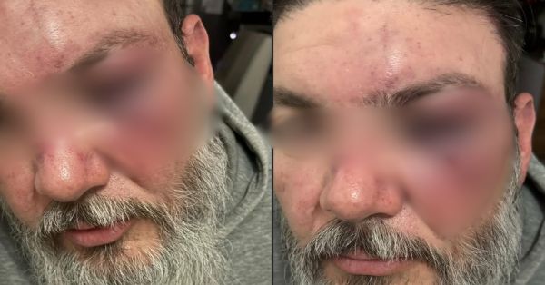 Detiene SSP a un implicado en la agresión a Fher Jara