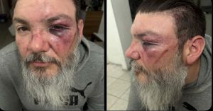 Agreden brutalmente a aficionado de los Pumas en el Cuauhtémoc