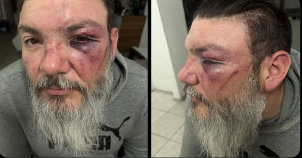 Agreden brutalmente a aficionado de los Pumas en el Cuauhtémoc