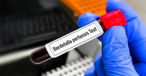 Contabilizan en México 618 casos de tosferina en el 2025