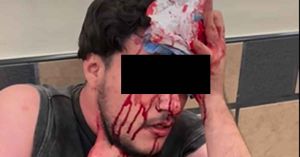 Atacan a cliente de La Oriental en la CAPU; agresor ya estaría identificado