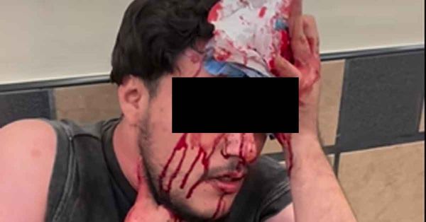 Atacan a cliente de La Oriental en la CAPU; agresor ya estar&iacute;a identificado