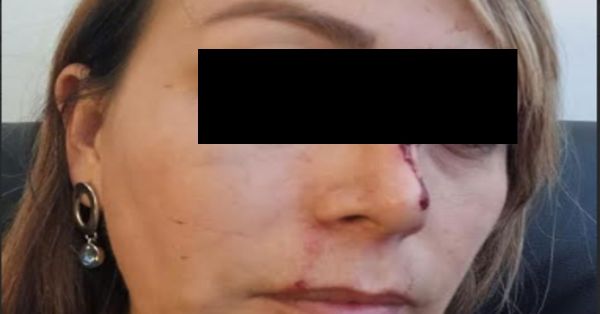 Denuncia Miriam amenazas por parte de su ex pareja, teme por su vida