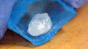 Aprehende FGR a investigado por delitos contra la salud en Puebla