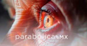 Promueve DIF la Jornada Gratuita de Cirug&iacute;as de cataratas