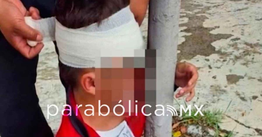 Hospitalizan a estudiante en Atlixco tras agresi&oacute;n por presunto bullying