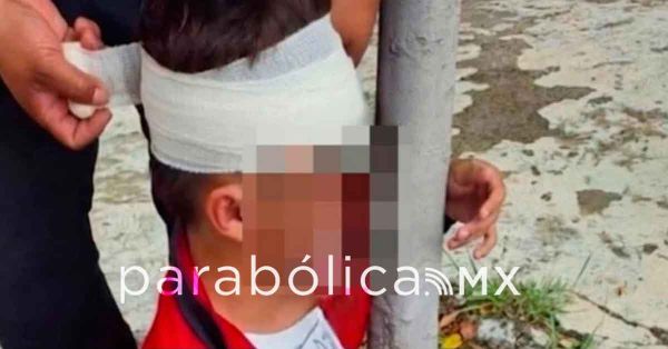 Hospitalizan a estudiante en Atlixco tras agresi&oacute;n por presunto bullying